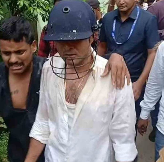 Abhishek Faces Protest